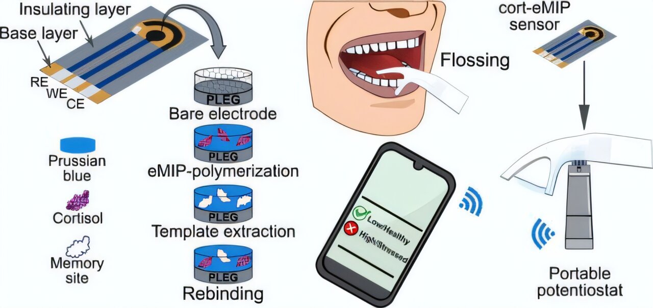 Un nouveau Flasse dentaire permet une surveillance des stress à domicile